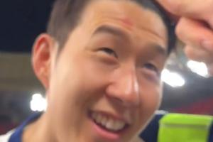 奖杯印记🤣孙兴慜额头挂彩：我捧杯时有人推我，蹭到了